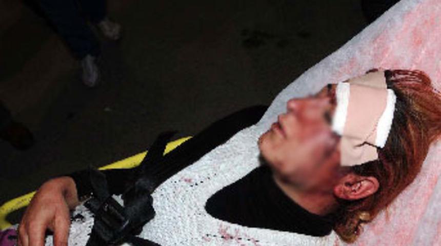 Eski koca dehşet sa&ccedil;tı