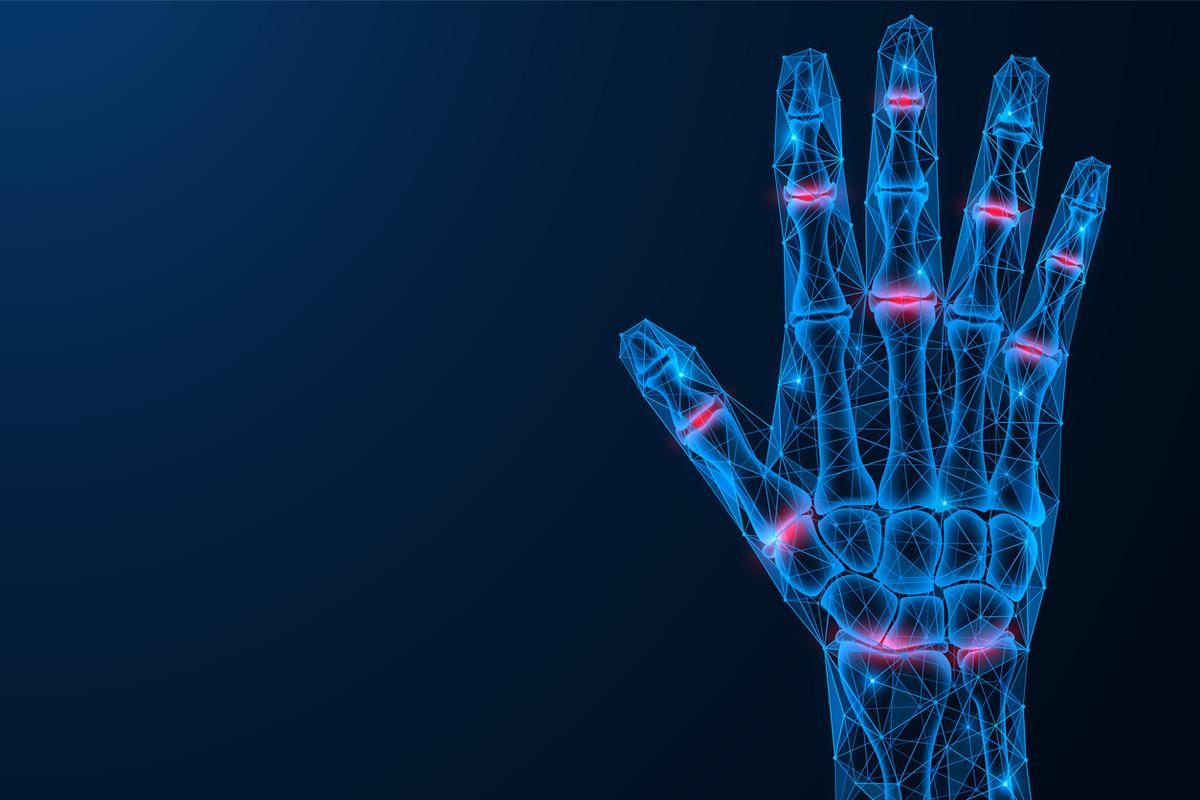 Parmak eklemlerindeki ağrıyı hafife almayın! Uzmanı romatoid artrite karşı uyardı 2