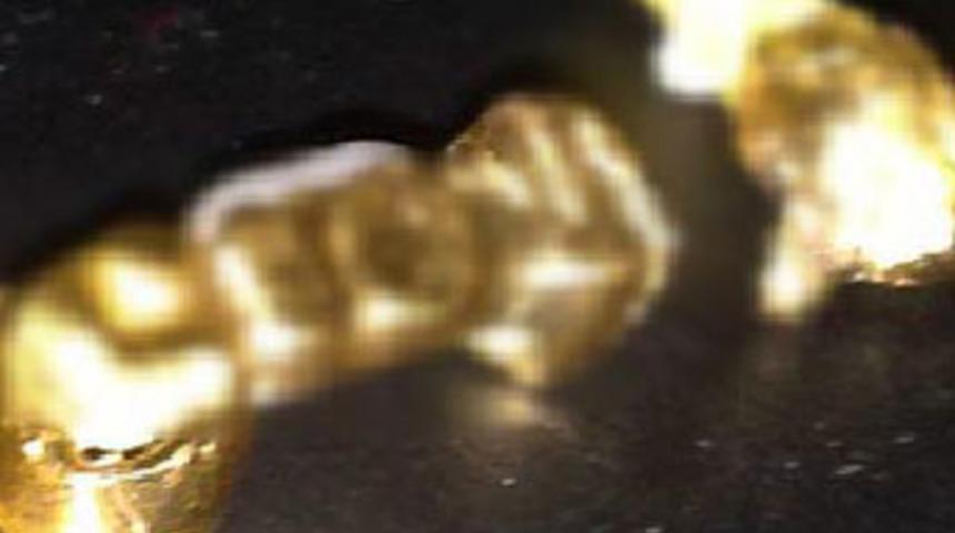 Hastanede &ouml;len kadının dişlerini s&ouml;kt&uuml;ler