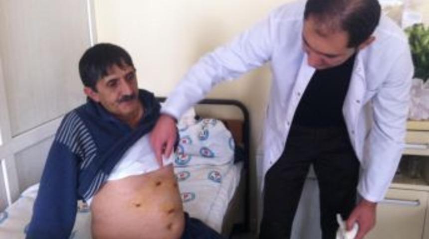 Muş Devlet Hastanesi'nde ikinci kapalı mide ameliyatı