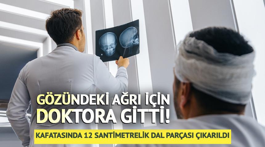 G&ouml;z&uuml;ndeki ağrı i&ccedil;in doktora gitti! Kafatasında 12 santimetrelik dal par&ccedil;ası &ccedil;ıkarıldı