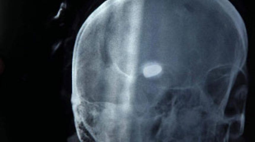 Kendisini vuran, &ouml;l&uuml;nce ortaya &ccedil;ıkacak