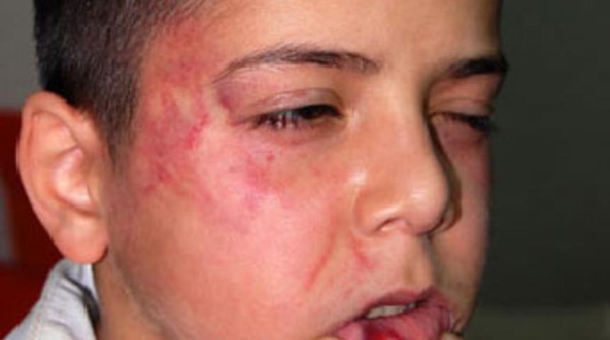 Kadın &ouml;ğretmen dehşet sa&ccedil;tı