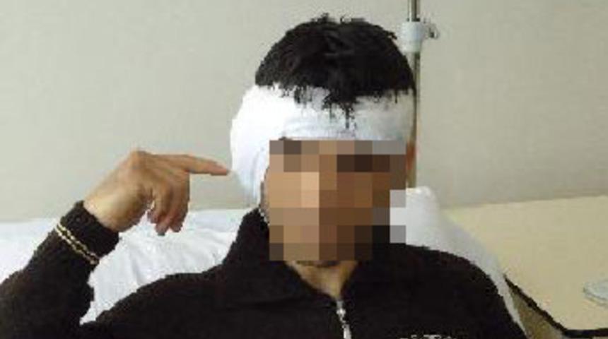 Kulak kopartan kavga