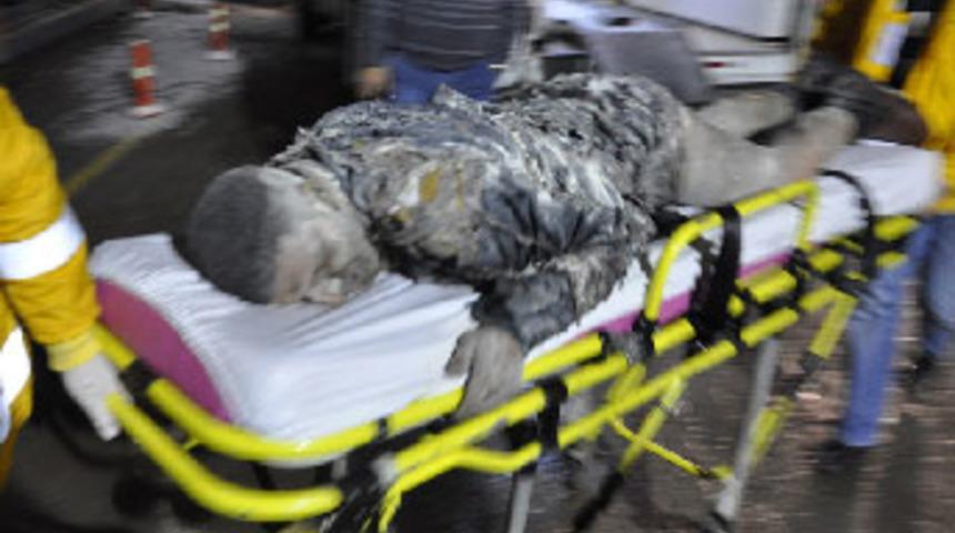 Eşine kızdı, &uuml;zerine benzin d&ouml;k&uuml;p ateşe verdi