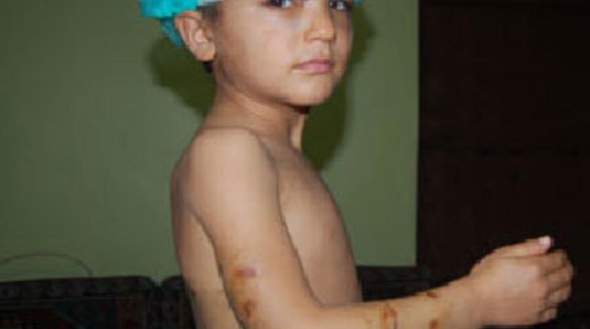 Minik &Ouml;mer'e, k&ouml;pekler saldırdı