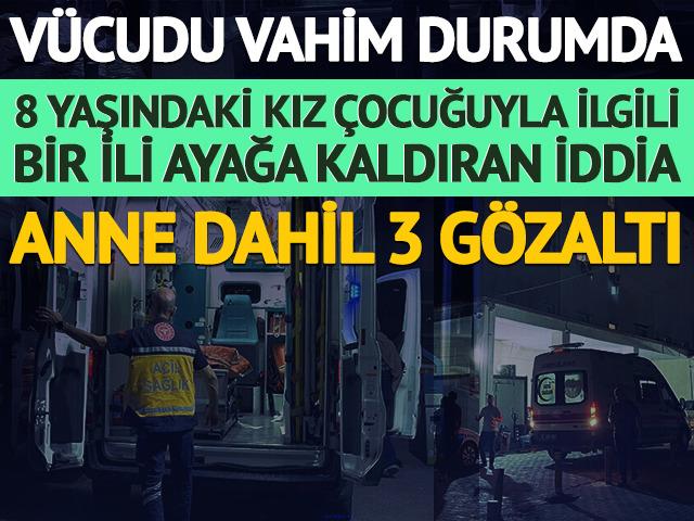 8 yaşındaki kız &ccedil;ocuğuna annesinden &uuml;t&uuml;l&uuml; işkence