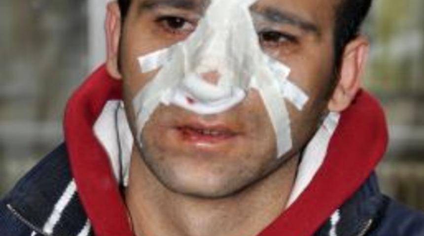 Minib&uuml;ste yer vermediği şahsın saldırısında burnu kırıldı