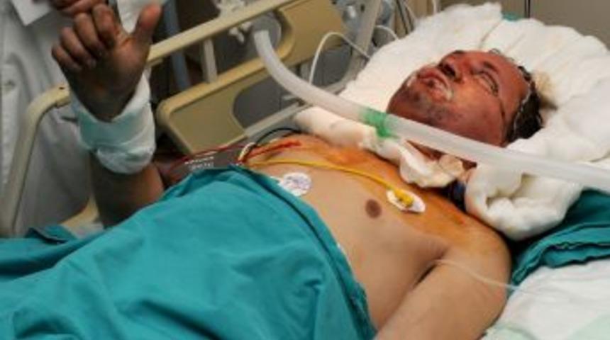 Y&uuml;z nakli olan Uğur Acar'ın fotoğrafları basına dağıtıldı