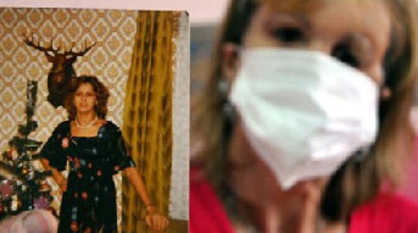 İlk y&uuml;z nakli umut oldu