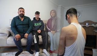 &Ouml;nce d&ouml;vd&uuml;, sonra temizlik yaptırdı: 'Otururken bile ağrı &ccedil;ekiyorum'