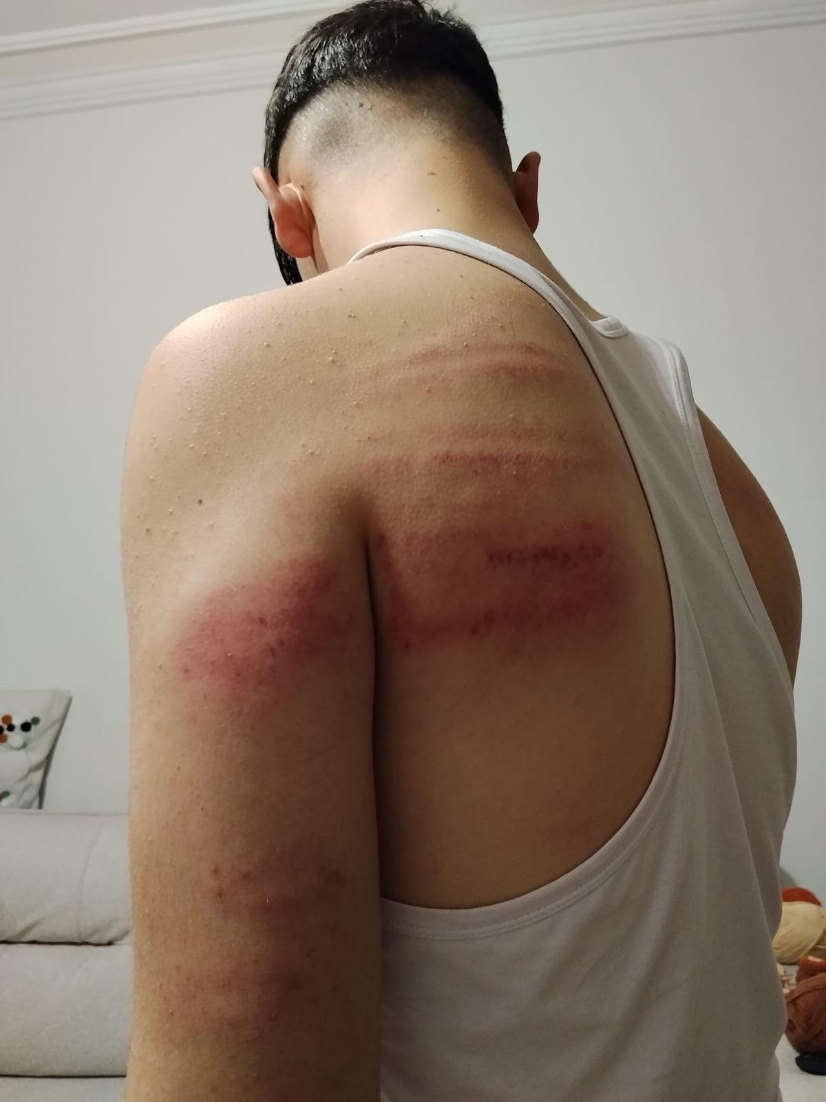 Önce dövdü, sonra temizlik yaptırdı: Otururken bile ağrı çekiyorum 1