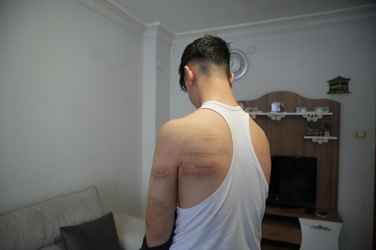 Önce dövdü, sonra temizlik yaptırdı: Otururken bile ağrı çekiyorum 3