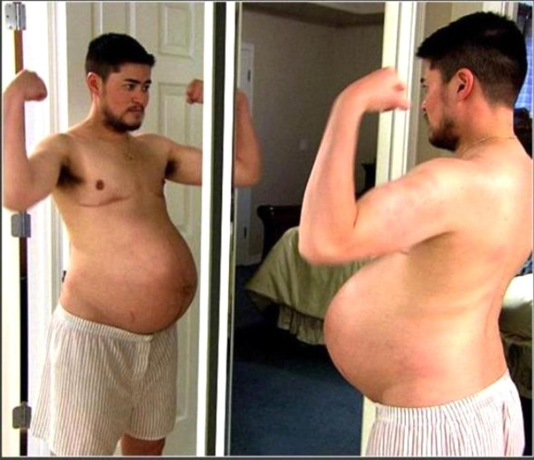  Doğum yapan ilk erkekti! Son hali şoke etti