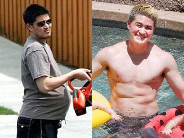  Doğum yapan ilk erkekti! Son hali şoke etti G5