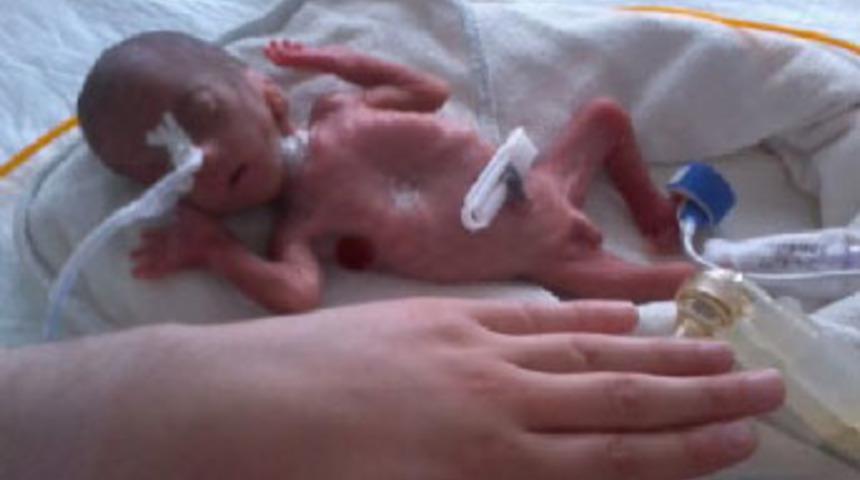 Parmak &ccedil;ocuk taburcu oldu