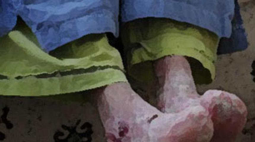 "&Ccedil;ocuğum g&ouml;z&uuml;m&uuml;n &ouml;n&uuml;nde eriyor"