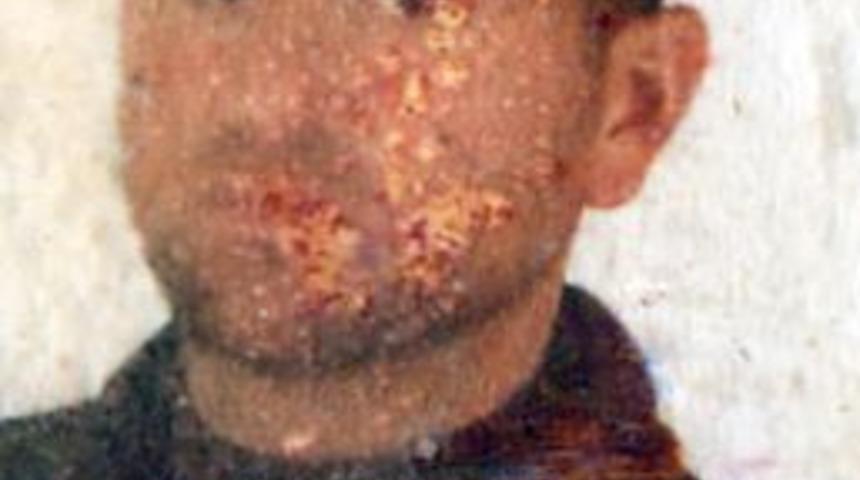 Y&uuml;ksek gerilim akımına kapılan iş&ccedil;i hayatını kaybetti