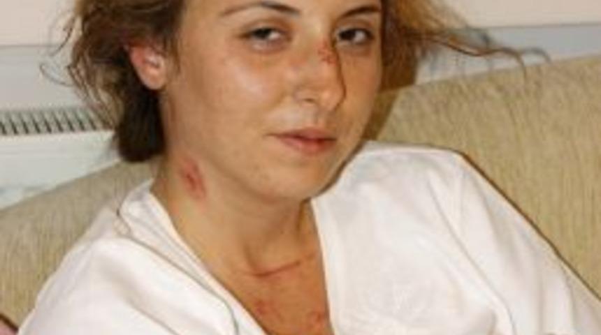 Gasp&ccedil;ı dehşetini yaşayan &ouml;ğretmen: O an &ouml;leceğimi hissettim