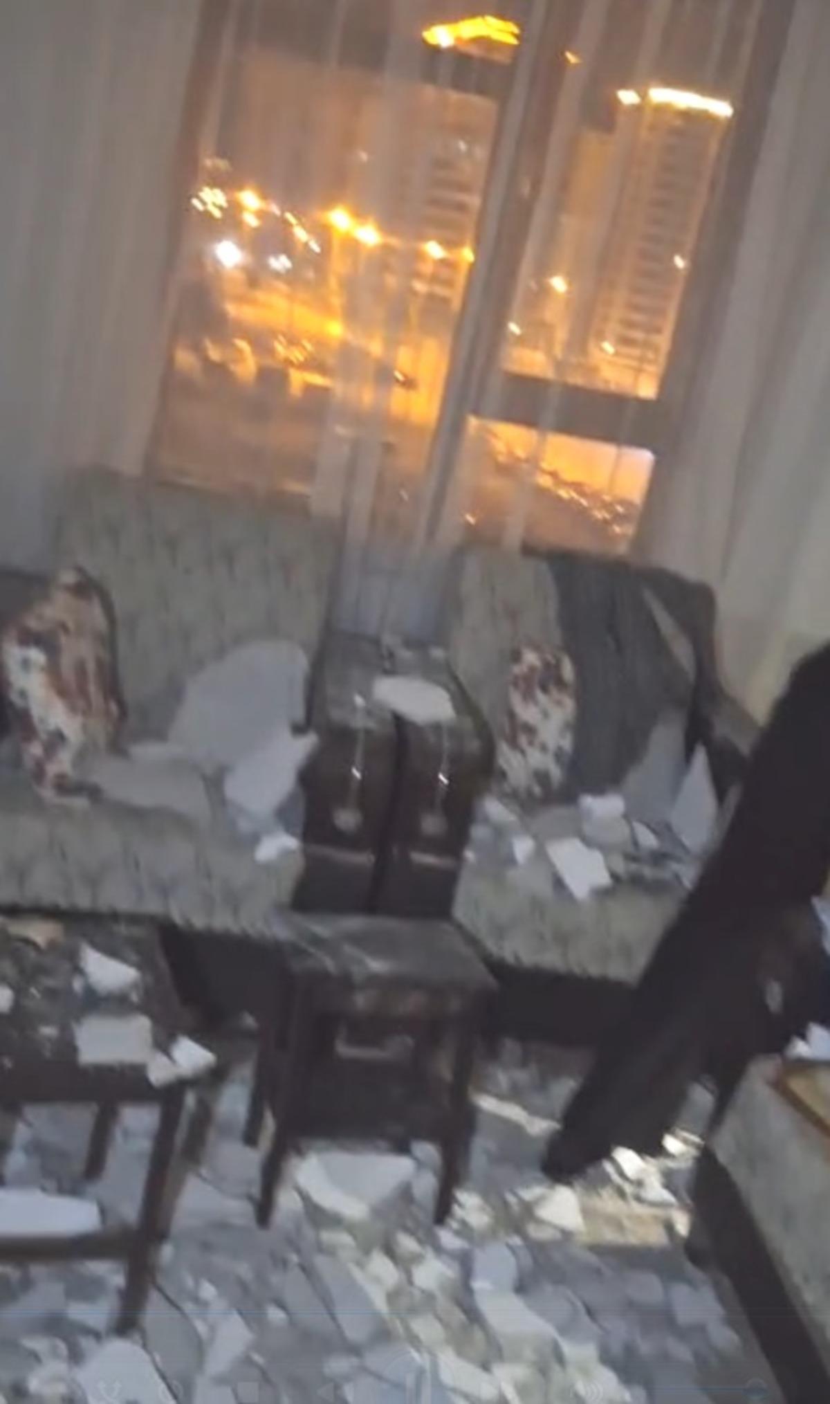 Kayseri de akılalmaz olay! Evde otururken tavan kafasına çöktü: Görme kaybı yaşadı 3