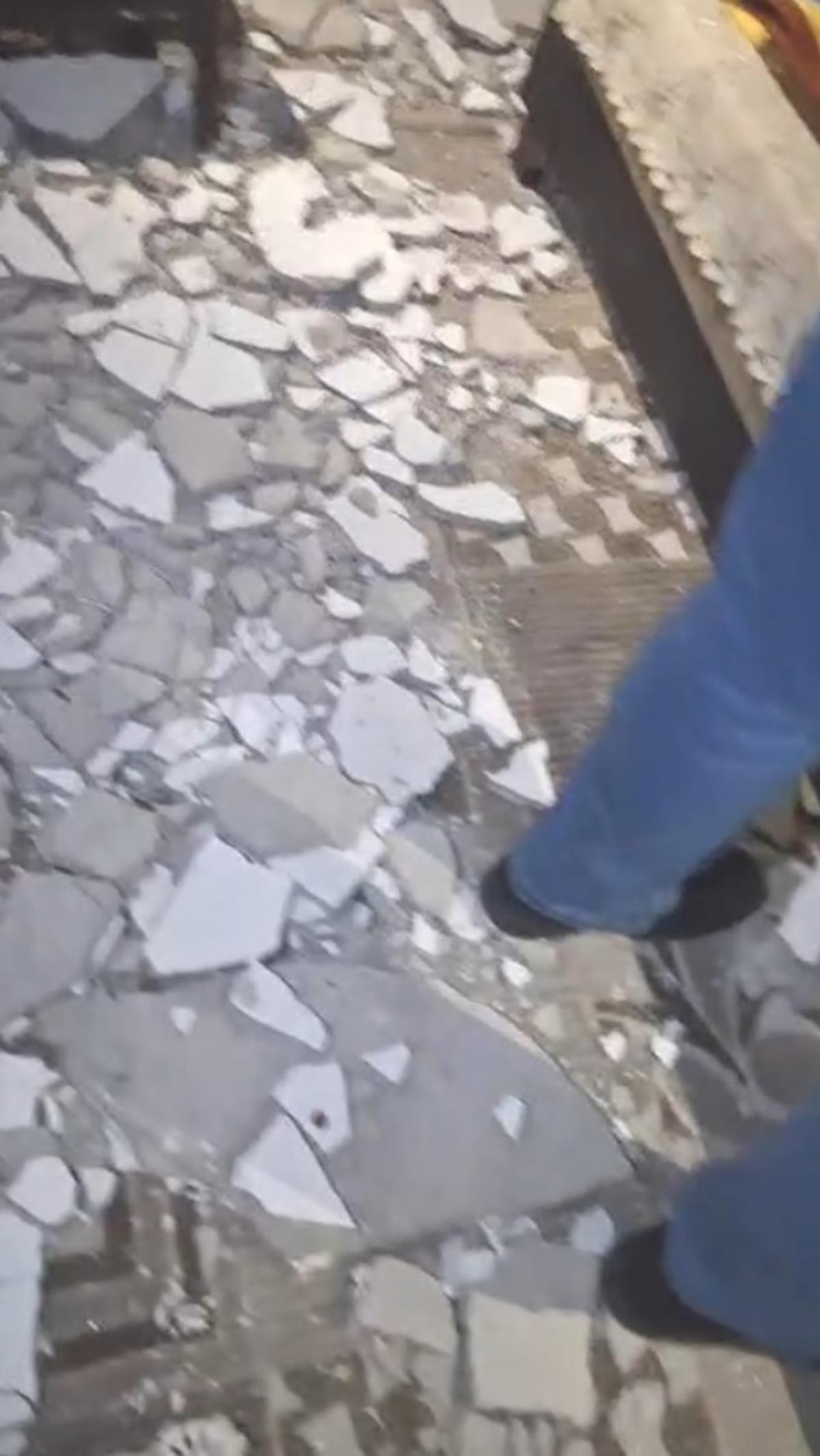 Kayseri de akılalmaz olay! Evde otururken tavan kafasına çöktü: Görme kaybı yaşadı 2