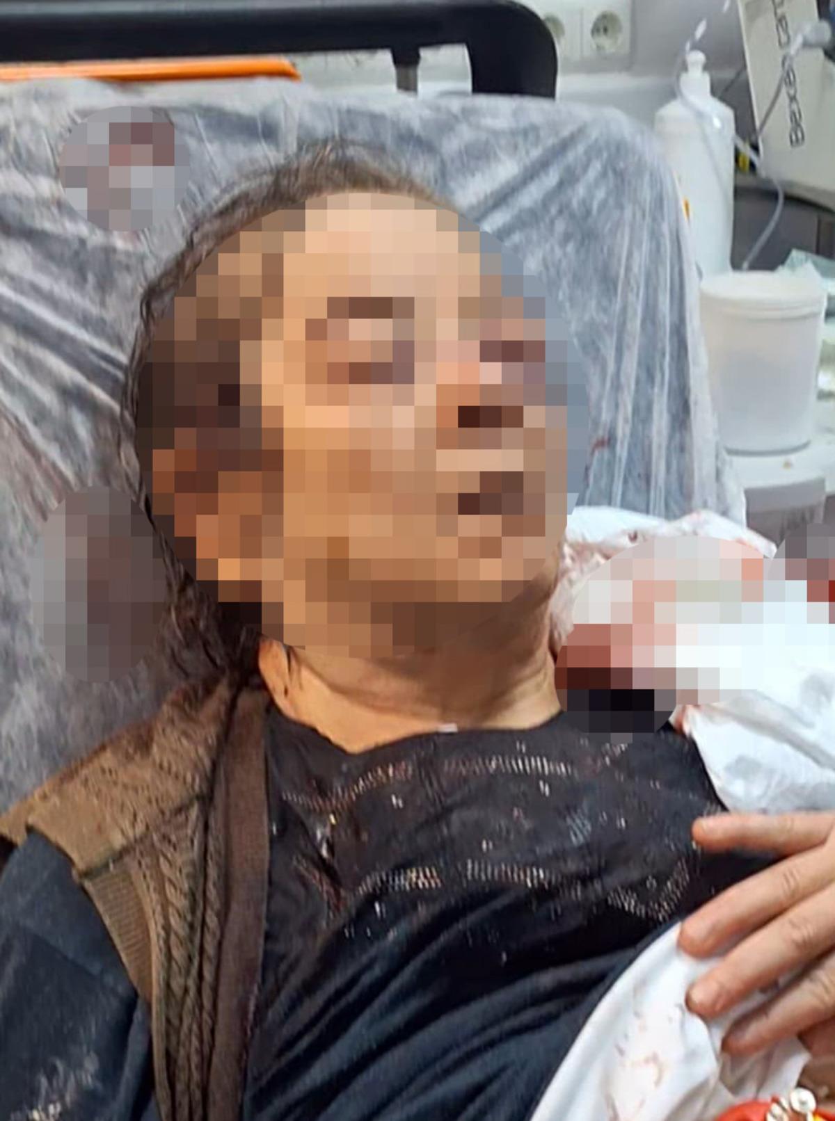 Kayseri de akılalmaz olay! Evde otururken tavan kafasına çöktü: Görme kaybı yaşadı 1