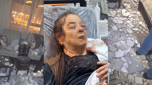 Kayseri'de akılalmaz olay! Evde otururken tavan kafasına çöktü: Görme kaybı yaşadı