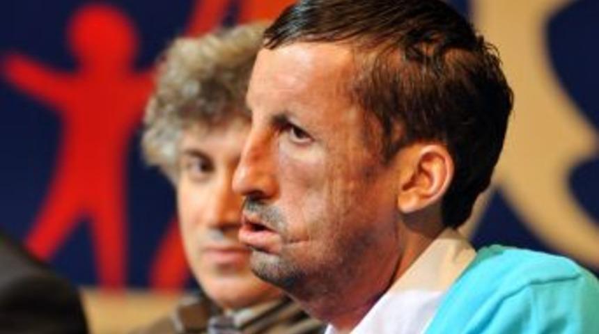 İlk yüz naklinin faturası 250 bin lira, kararı komisyon verecek