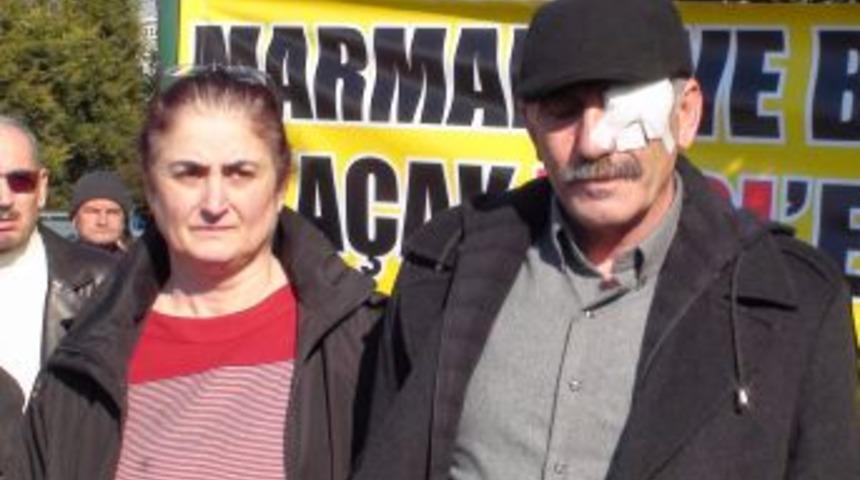 Trolc&uuml;n&uuml;n silahlı saldırısında g&ouml;z&uuml;n&uuml; kaybeden balık&ccedil;ı taburcu oldu