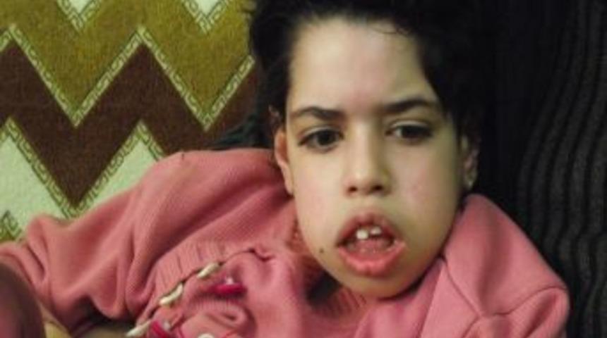 Engelli Mukaddes'in ailesi tedavi i&ccedil;in yardım bekiliyor