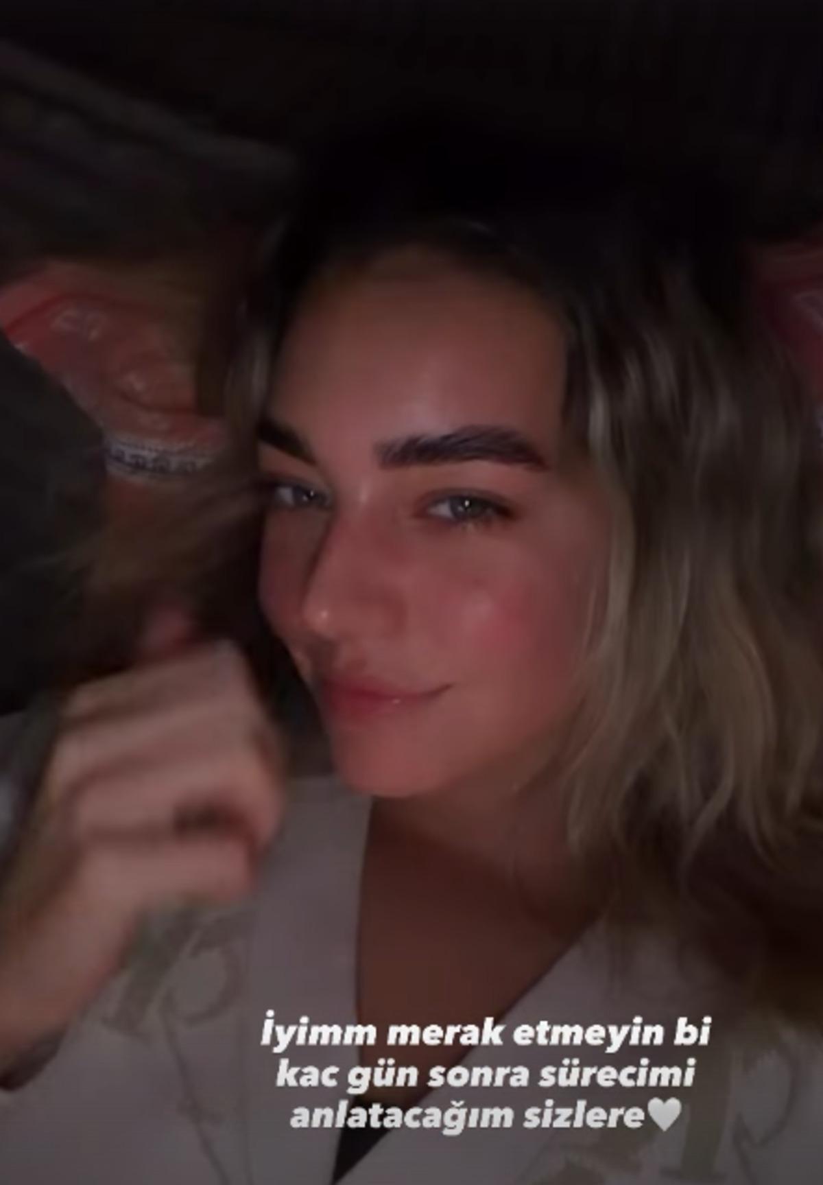 Survivor Aycan Yanaç göğüslerine silikon taktırdı! Reklam yapınca gündem oldu 4