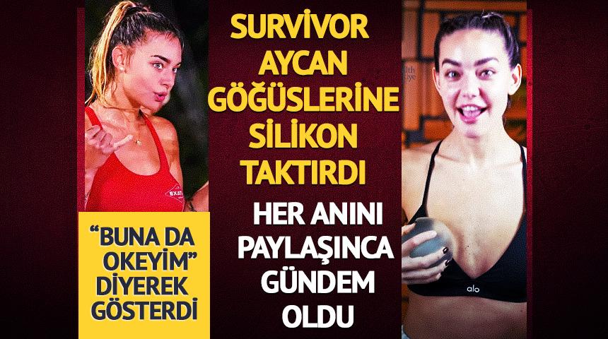 Survivor Aycan g&ouml;ğ&uuml;slerine silikon taktırdı! Her anını paylaştı