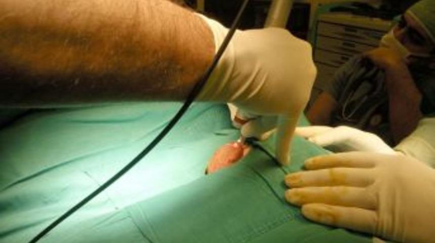 Uludağ &Uuml;niversitesi, damar yumaklarını lazerle kansız tedavi ediyor