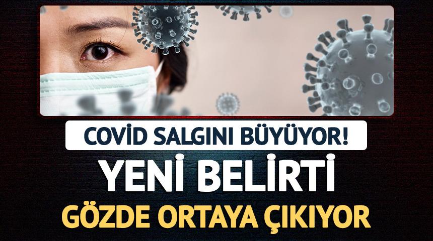 Covid salgını b&uuml;y&uuml;yor! Yeni belirti g&ouml;zde ortaya &ccedil;ıkıyor