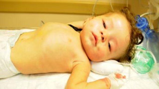 Alkollik babası tarafından dövülen bebeği yaşatmak için doktorlar seferber oldu