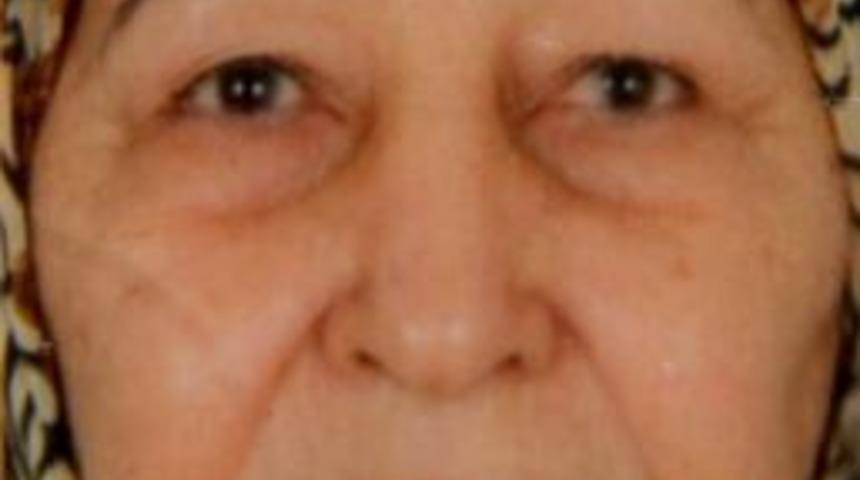 Hastane &ouml;n&uuml;nde iki aracın &ccedil;arptığı Al, 21 g&uuml;n sonra &ouml;ld&uuml;