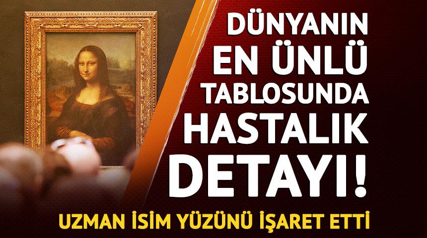 D&uuml;nyanın en &uuml;nl&uuml; tablosunda hastalık detayı! Uzman, Mona Lisa'nın y&uuml;z&uuml;n&uuml; işaret etti