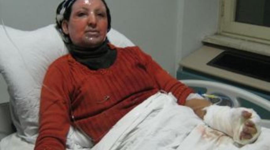 Doğubayazıt'ta t&uuml;p patladı: 2 yaralı