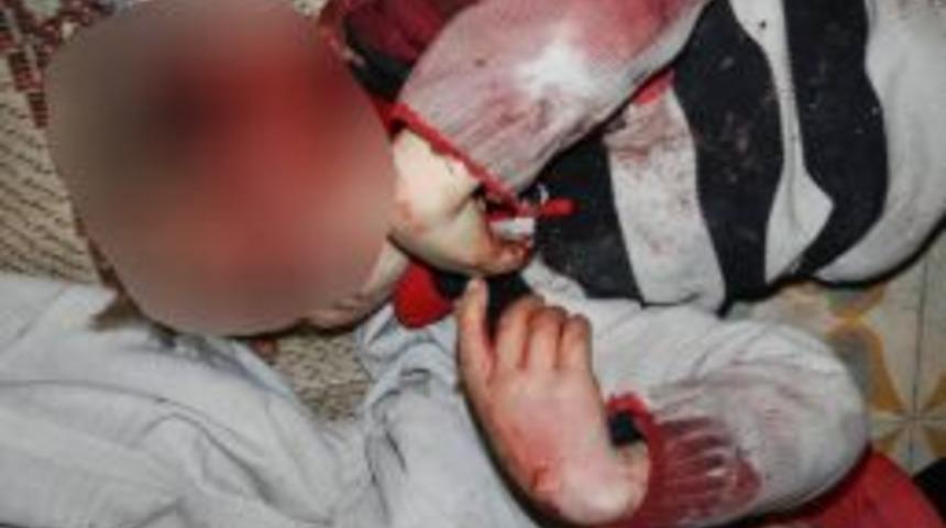 Suriye&rsquo;deki katliamın fotoğrafları, vahşeti g&ouml;zler &ouml;n&uuml;ne seriyor