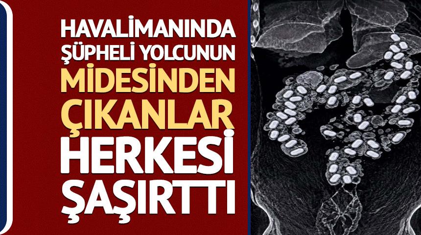 Havalimanında ş&uuml;pheli yolcunun midesinden 322 gram metamfetamin &ccedil;ıktı