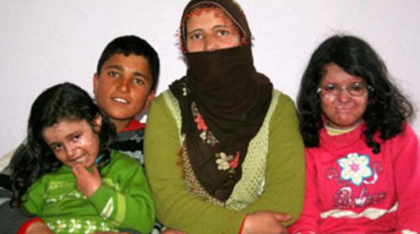 G&uuml;neşe hasretler