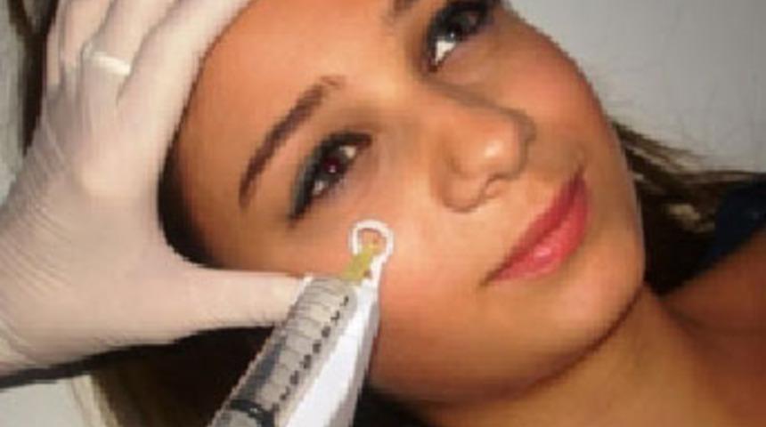 Kendi kanınla g&uuml;zelleşmenin sırrı