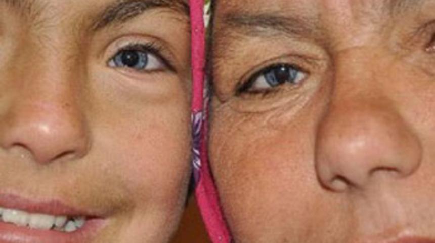 Annesi ile kızının g&ouml;zleri iki renkli