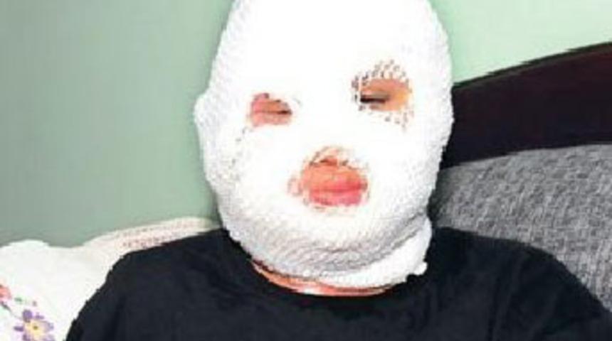 &Ccedil;akmak gazıyla kafayı bulup arkadaşını yaktı