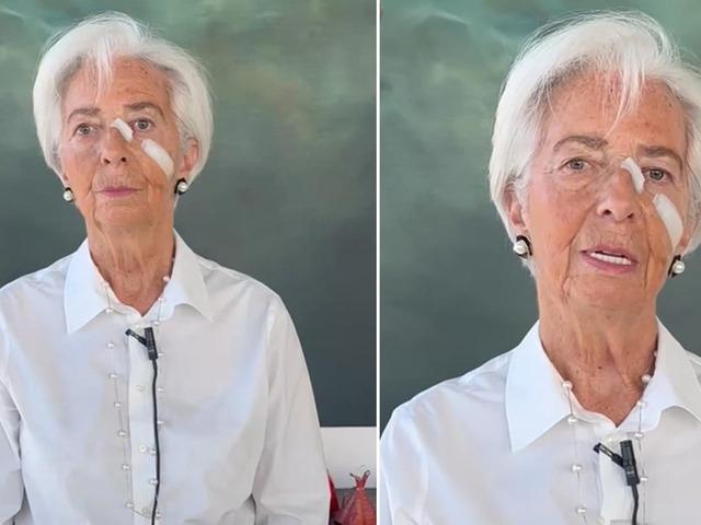 Avrupa Merkez Bankası Başkanı Lagarde istifa videosu &ccedil;ekti! Y&uuml;z&uuml;ndeki bantlar dikkat &ccedil;ekti