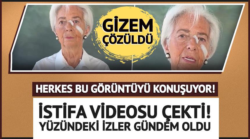 Avrupa Merkez Bankası Başkanı Lagarde istifa videosu &ccedil;ekti! Y&uuml;z&uuml;ndeki bantlar dikkat &ccedil;ekti