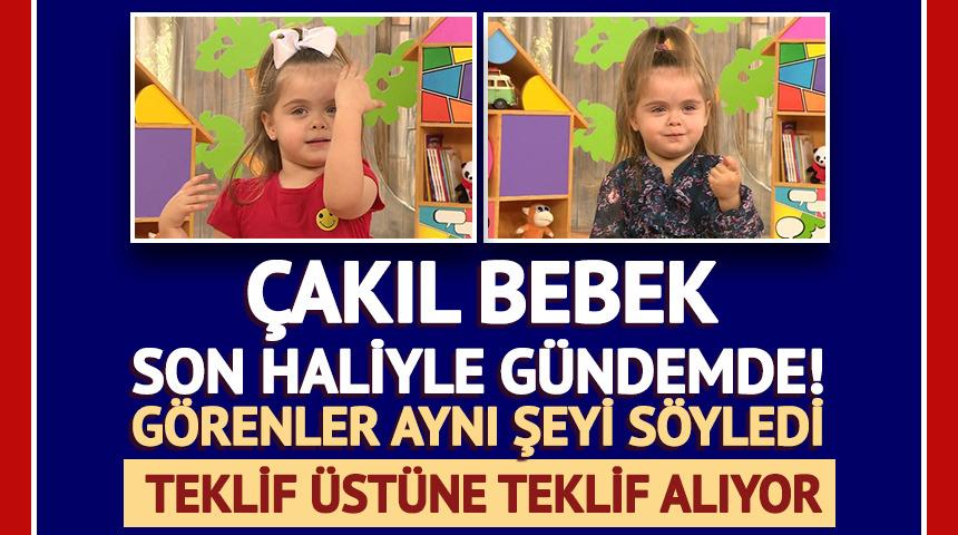 &Ccedil;akıl Bebek son haliyle g&uuml;ndem oldu! Teklif yağıyor