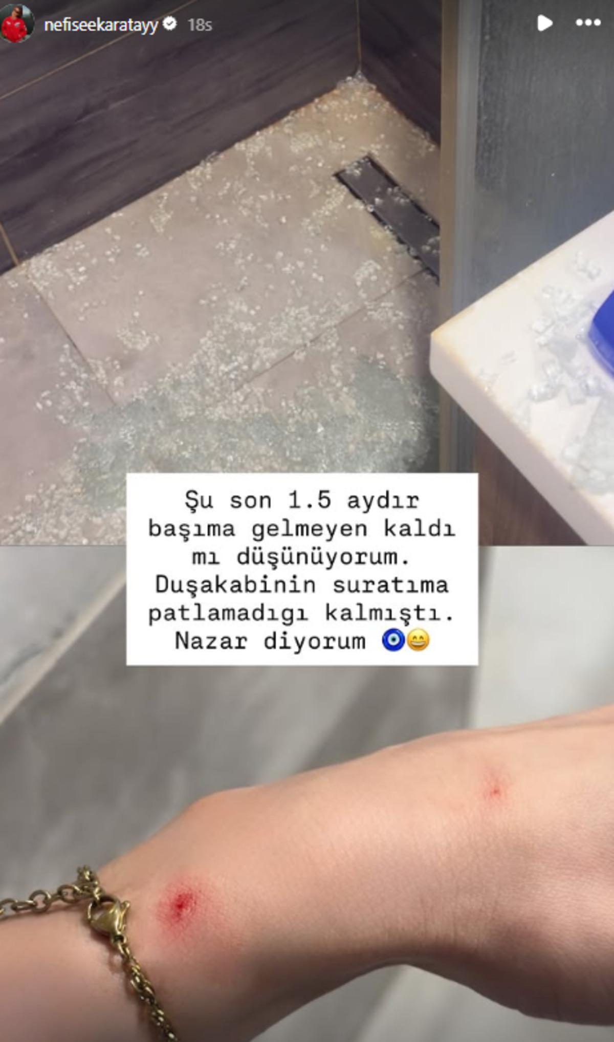 Nefise Karatay ın başına gelmeyen kalmadı! Duş kabini suratına patladı 2