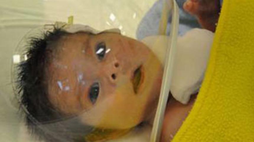 Bağırsağından yemek borusu yapılacak