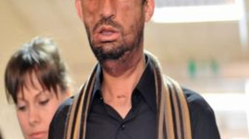 Uğur Acar: Yeni yüzüme alıştım